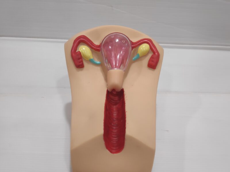 Human IUD Model