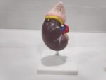 Human Kidney Model