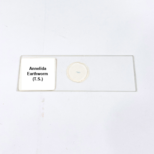 Annelida Earthworm (T.S.)