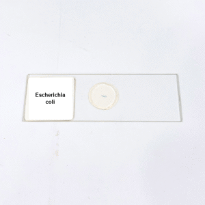 Escherichia coli