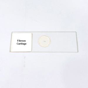 Fibrous Cartilage