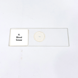 H. Blood Smear
