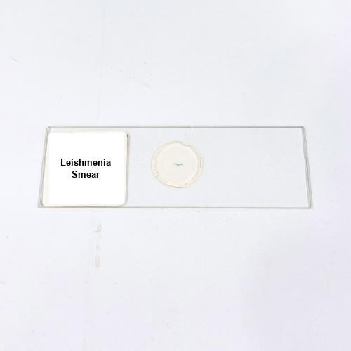Leishmenia Smear
