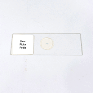 Liver Fluke Redia