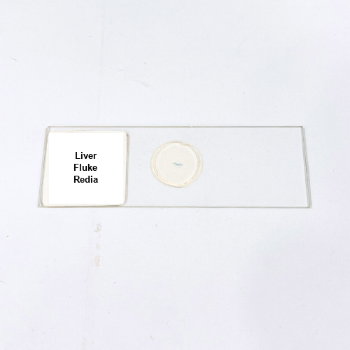 Liver Fluke Redia