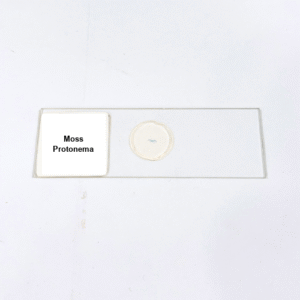 Moss Protonema