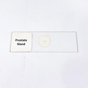 Prostate Gland