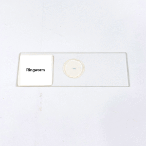 Ringworm