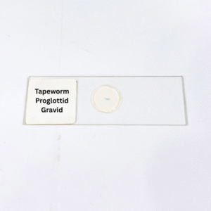 Tapeworm Proglottid Gravid