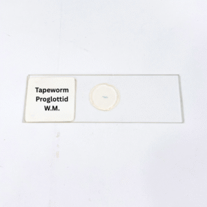 Tapeworm Proglottid W.M.