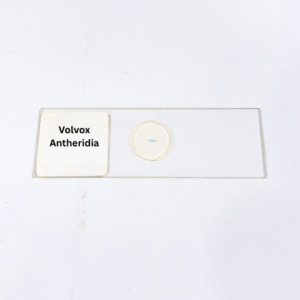 Volvox Antheridia